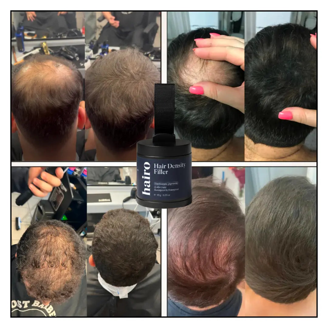 Hair Density Filler
